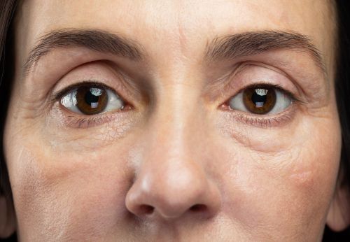 Close up on a woman's face to emphasize aging around the eyes